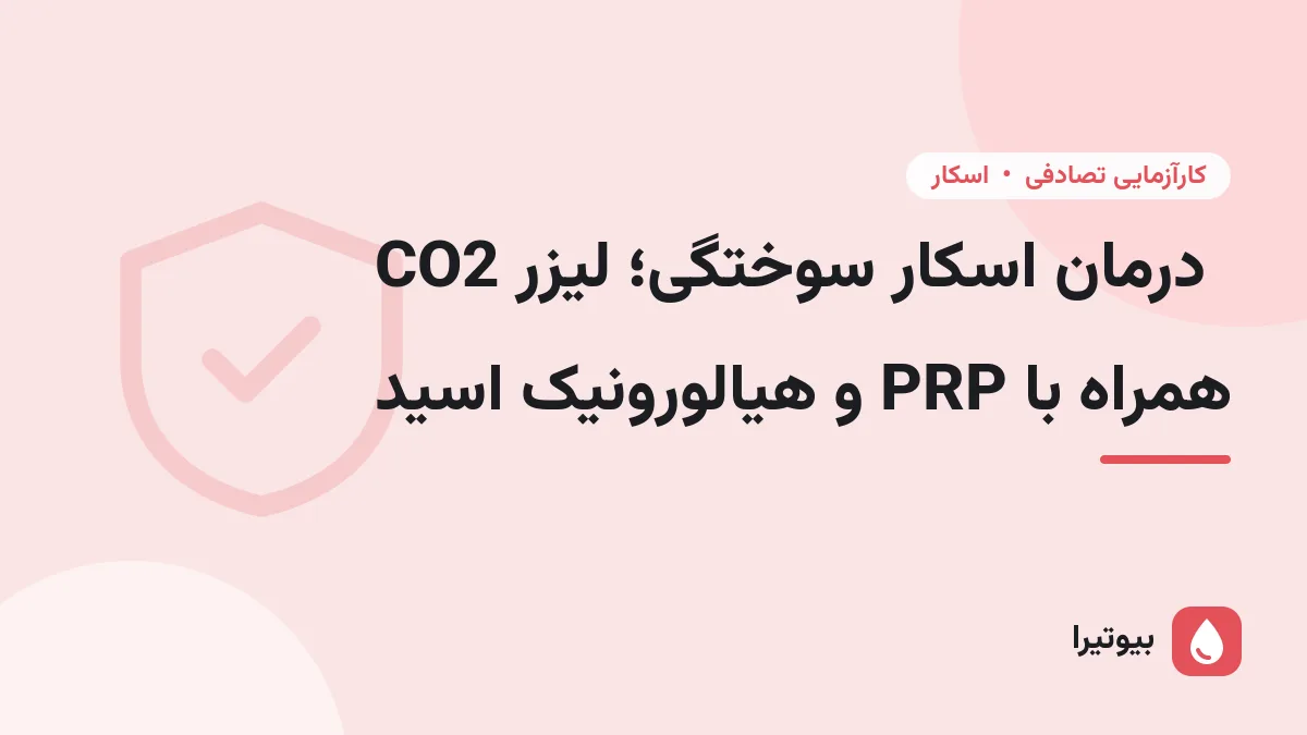درمان اسکار سوختگی؛ لیزر CO2 همراه با PRP و هیالورونیک اسید