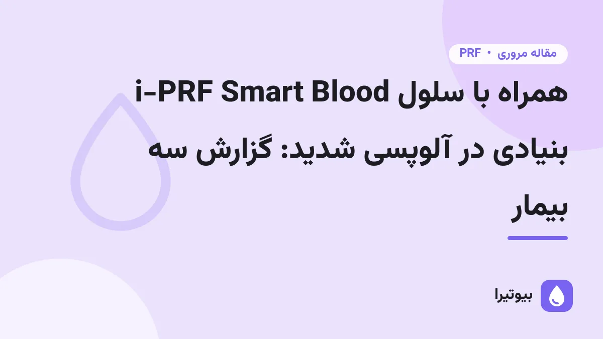 i-PRF Smart Blood همراه با سلول بنیادی در آلوپسی شدید: گزارش سه بیمار