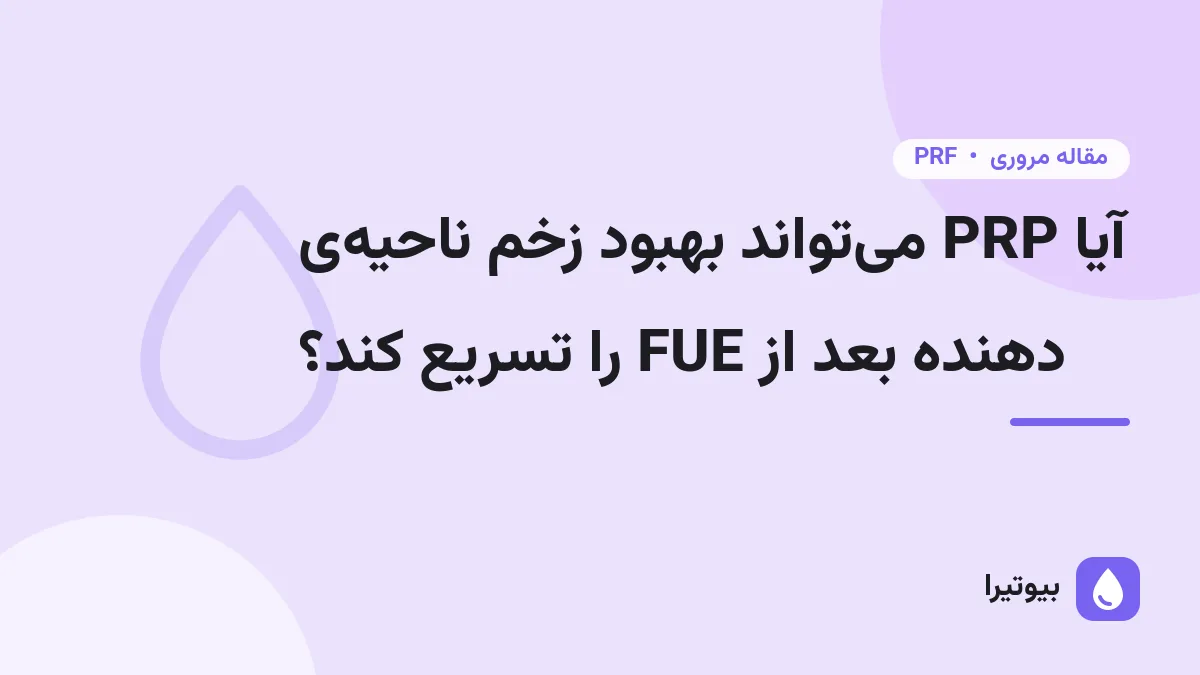 آیا PRP می‌تواند بهبود زخم ناحیه‌ی دهنده بعد از FUE را تسریع کند؟